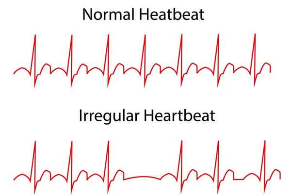 regular-vs-irregular